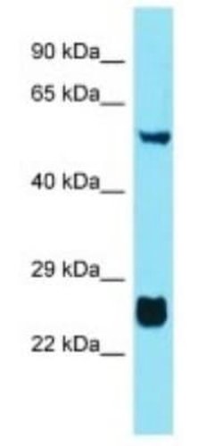FAM90A10P Rabbit anti-Human, Polyclonal, Novus Biologicals:Antibodies:Primary